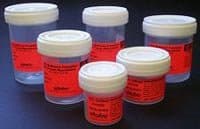 Globe Scientific Tite-Rite 6522FL Polypropylene 10% Neutral Buffered Formalin Pre-Filled Container with Polyethylene Cap, 60ml Capacity (Case of 100)