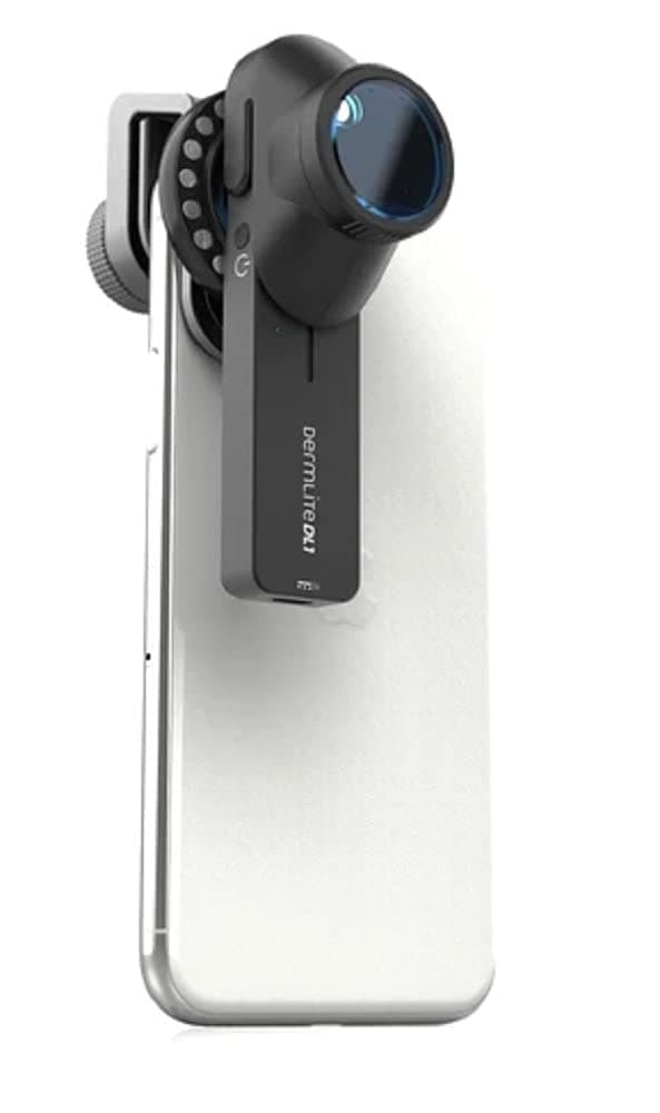 3GEN DL1 Epiluminescence Dermlite Dermatoscope