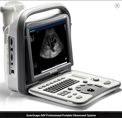 Sonoscape A6V
