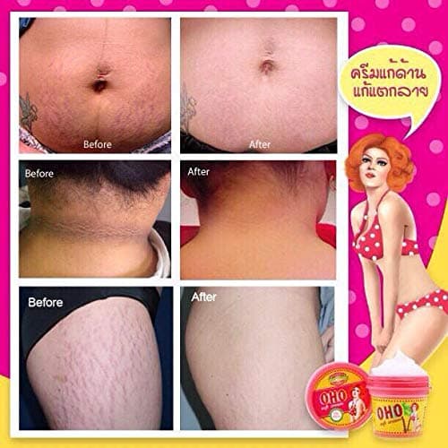 Net.WT 100Gram. OHO Soft Cream GLUTA White Remove Dead Skin Cells OHO Clear dark whiteing,Rough Skin Bikini,whitening with Collagen,Gluta