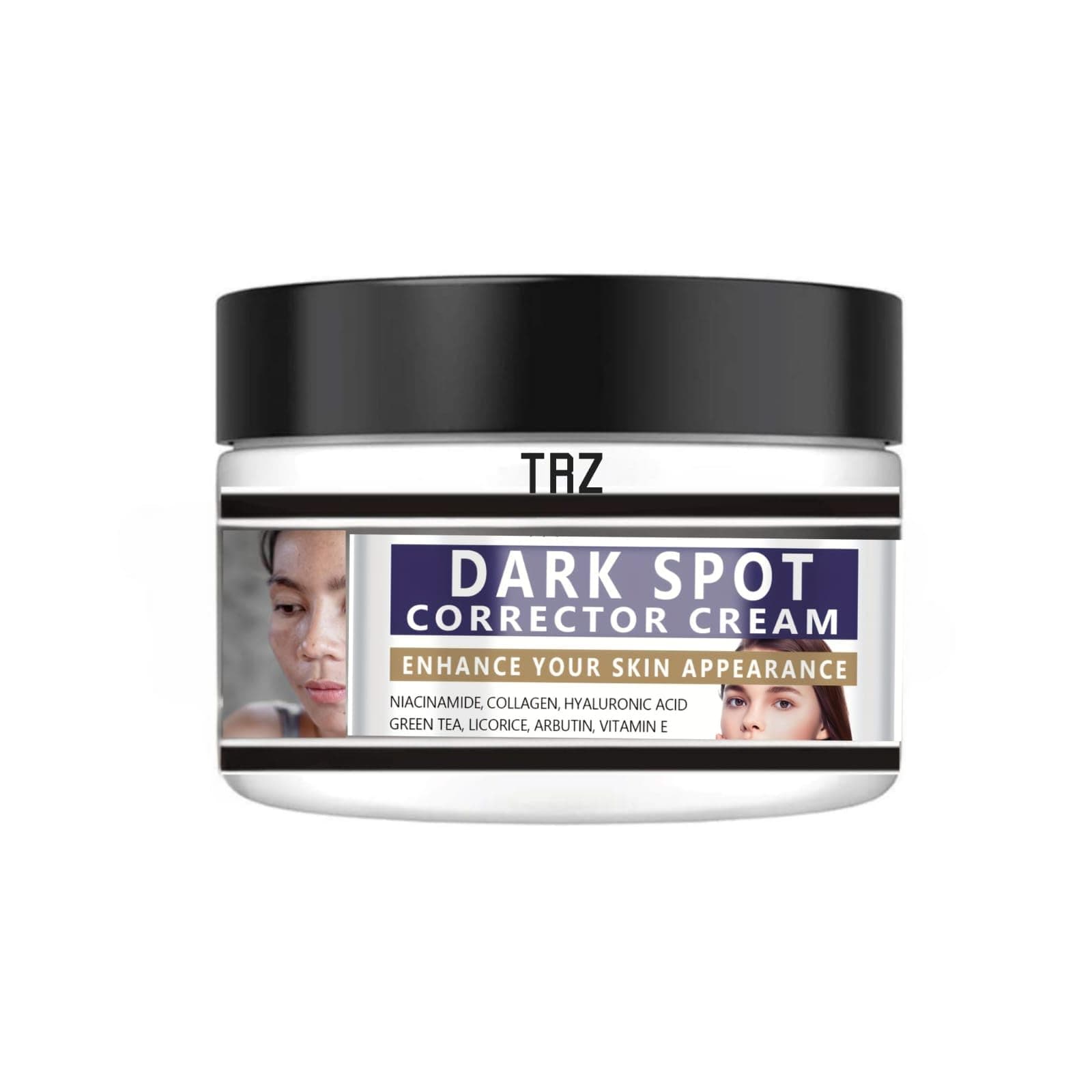 Ark Spot Remover Cream for Hyperpigmentation, Dark Spots, Age Spots, Freckles, Improves Skin Texture, No Chemical Bleaching Agents