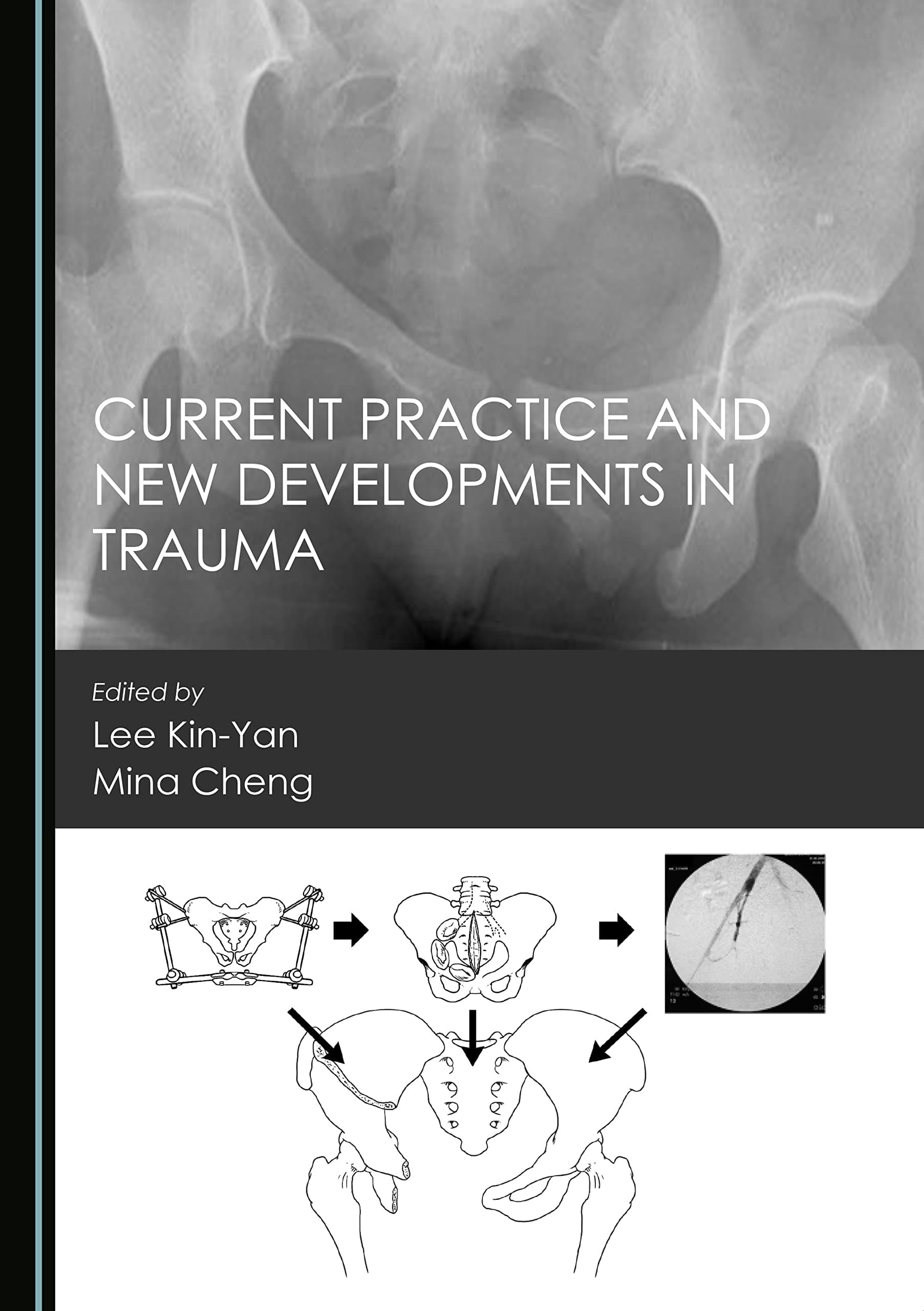 Current Practice and New Developments in Trauma