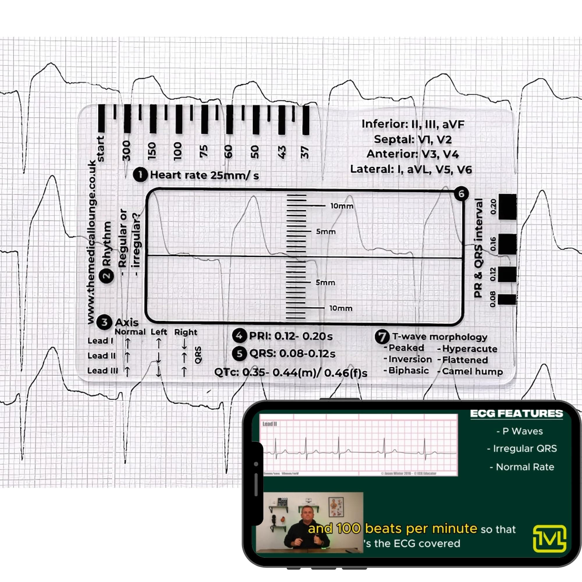 ECG Ruler with Heart Rate, Axis, PR Interval, QRS Duration, QTc Interval, and T-Wave Morphology Indicators