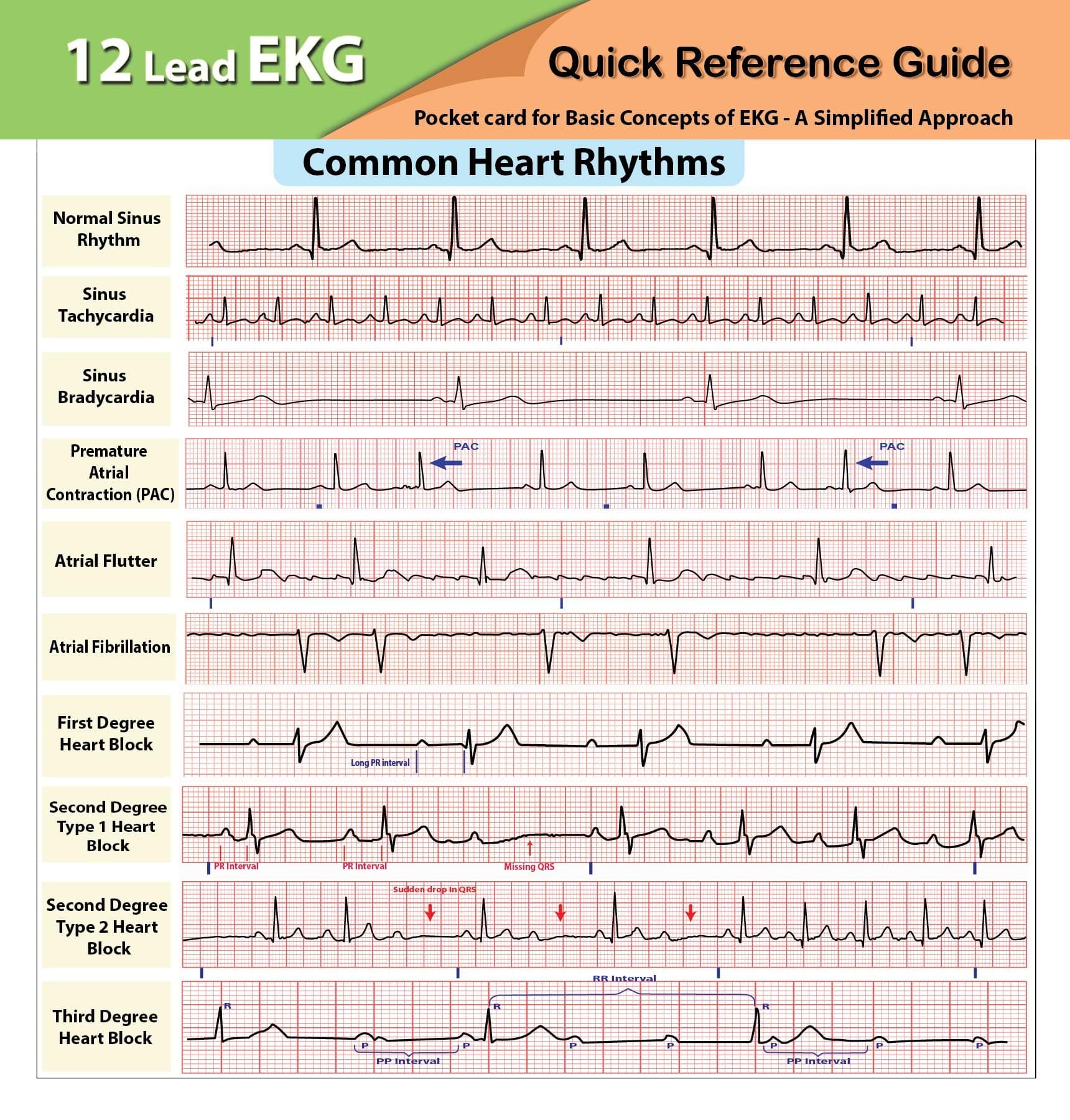 12 Lead EKG Pocket Card